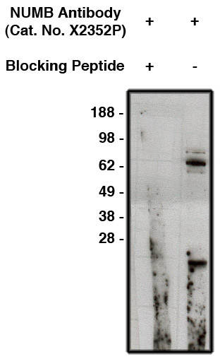 Western blot using anti-NUMB antibody (Cat. No. X2352P) on human brain lysate (14µg/lane).  Antibody was used with (lane 1) and without (lane 2) blocking peptide at 10µg/ml.